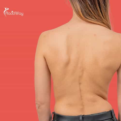 Restoring Movement Without Surgery: Argentina’s Spine Stem Cell Solutions for Miami Patients